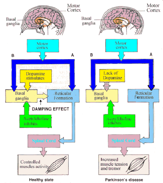 Dopamin Parkinson Belirtileri ve Tedavisi